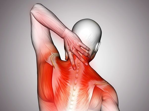 A incrível transformação após a cirurgia da Síndrome do Desfiladeiro